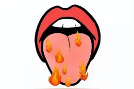 舌头下面长了丝状的小肉揪，该不会是尖锐湿疣吧？图片