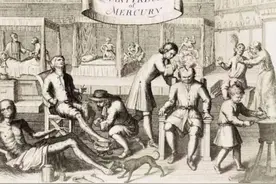 性病梅毒：因糜烂生活，导致梅毒泛滥的，欧洲贵族们。图片