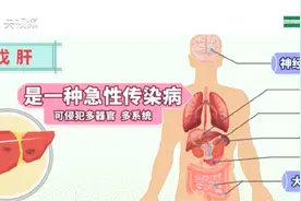 男子吃猪肝后确诊肝炎尿如浓茶图片