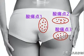 中老年人右侧臀部疼痛，并非坐骨神经痛！究竟啥原因？详细告知您图片