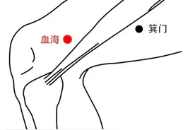 夏季就怕湿缠身！推荐三粥三茶，祛湿又健脾，赶紧转发给需要的朋友吧……图片