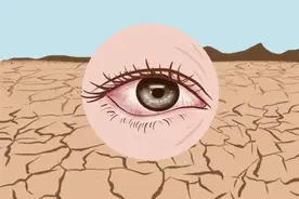 眼干眼涩有干眼症，别担心，中医有妙招，看到就是赚到！图片