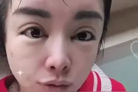 医美巨头于文红素颜照曝光，眼皮宽到吓人，与网图差别真大图片