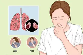 支扩、肺气肿，咳黄浓痰，走路气喘！教授：不算重，尽快治疗！图片