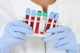 医生提醒：肌酐超这个标准，不是好现象，建议管住嘴巴图片