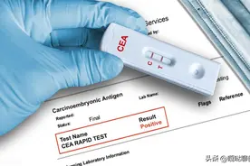 体检发现癌胚抗原升高怎么办？科学应对是关键图片