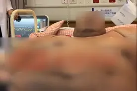 718斤小伙因情绪问题一顿吃25个包子图片