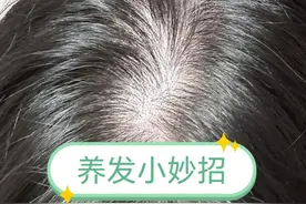 表姐教给我一个方法，坚持了一个月，头发竟然不掉了图片