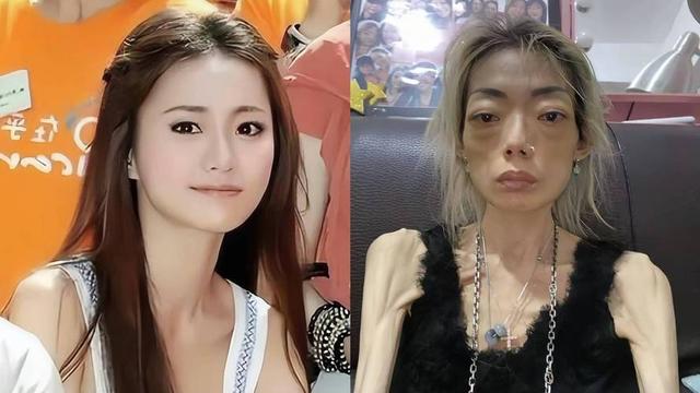 豪门玩物，8年被折磨成牙齿全掉	，不足80斤，形似骷髅，惨不忍睹