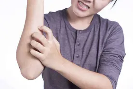 祛湿止痒艾灸的要穴，调理各种湿疹、风疹等痒证图片