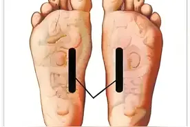 脚面筋痛太折磨人，快看看你是不是也中招！图片