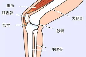走路经常“腿打软”？别大意，可能是膝盖出了问题图片