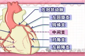 冠脉造影报告显示：左前降支血管狭窄75%，需要放支架吗？图片