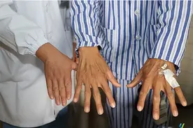 疯狂爆款标题！这家族竟然有7人确诊罕见的马凡氏综合征！图片