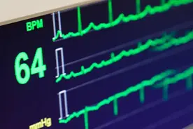 心率50与100，哪个更健康？什么时候需要药物治疗和手术？图片