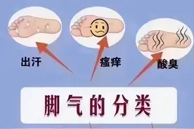 艾灸治疗脚气，艾灸这几个穴位，和脚气说拜拜！图片