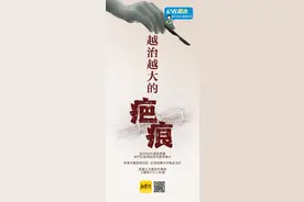 花6000元修复疤痕，治疗后反增瘢痕？济南华夏医院被市民投诉图片