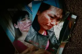 河南一女子被小三割脸百刀，惨遭毁容，儿女却称：活该，我爸没错图片