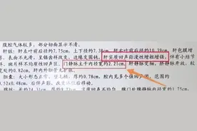 四个指标控制好，肝硬化、肝癌绕道走，很多人不知道图片