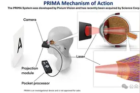2mm²芯片点亮盲人黑暗世界！马斯克前搭档出手，失明81%也能阅读图片