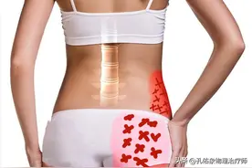 弯腰时右侧腰臀部疼痛不适、睡觉翻身更甚的一个案例分享图片