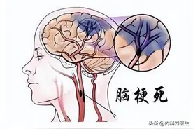 脑梗后别光顾着吃药！康复期最该补的3种维生素，加速脑梗恢复！图片