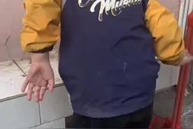 被生母虐待截肢男童期待长出新的脚：妈妈只是生病了，她很快就会好起来图片