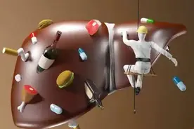 双脚或是肝脏的“报警器”，当脚部出现3大异样时，提示肝脏受损图片