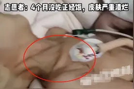 8个月女婴被虐到皮包骨后续：只喂山药粉，患9种重疾病，官方回应图片