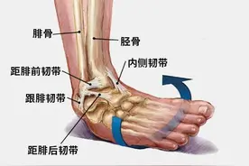 崴脚后休息静养就能康复？踝关节扭伤不可大意，本文帮你解除后患图片