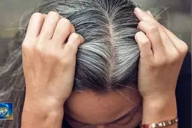 中医养生｜白发位置不同 反映的身体问题也不同图片