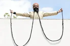 世界上身体部位最大的10个人，这些人的身体，和普通人不一样！图片