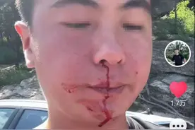 青岛逆行打人逃逸女司机是公职人员？官方有说法，被打男司机发声图片