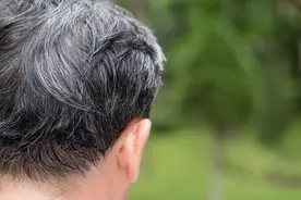 气血不足会脱发？用这2味药，养血生发！图片