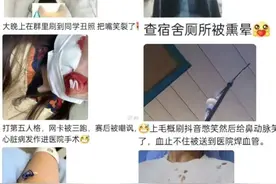 “脆皮大学生”上热搜，伸个懒腰脖子扭了？医生都惊了……图片