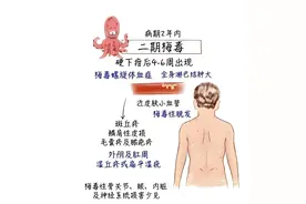 淋病和梅毒的历史渊源图片