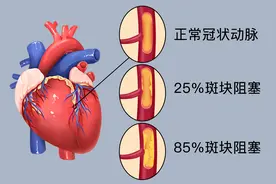 他汀类药物，可能一开始你就用错了！正确用法整理好了图片