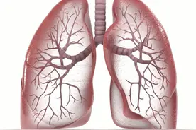 肺部检查选X光还是CT？选错可能耽误黄金治疗期！图片