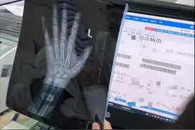 2025最新版“骨龄身高对照表”，看看你家孩子将来能长多高？图片