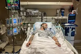 器官捐赠担心的事还是发生了！取心脏的手术中，脑死亡捐赠者醒了图片