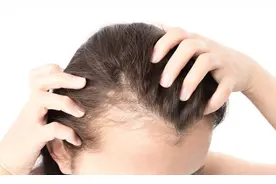 头发白的早、掉得快？中医教你3个小秘诀，稳固发根乌黑发图片