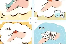 小伤口的正确处理：别让细菌有机可乘图片