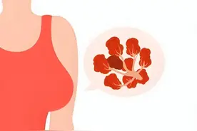 【深度解析】三阴性乳腺癌为何被称为"最凶险乳腺癌"？图片
