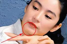 世界上最稀有7种人体特征，看看你占了几个，你会是天选之子吗？图片