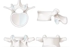 腰椎管狭窄怎么治？新康复法来尝试，缓解疼痛速速行动图片