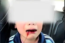 太可悲！山西被打女儿父亲已接受道歉，网友也无奈：对方7岁图片