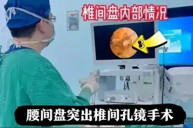 我的腰间盘突出治疗经验与教训（之三）图片