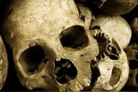 网友看到向佐最近的长相后表示：肾确实坏了图片