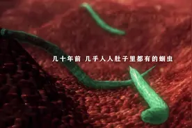 多年前，老一辈人说人人肚子几乎都有蛔虫，现在为什么很少听说？图片