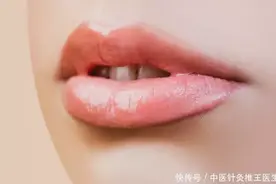 通过嘴唇看健康？告诫：若有5种唇色，或是疾病信号，需及时就医图片